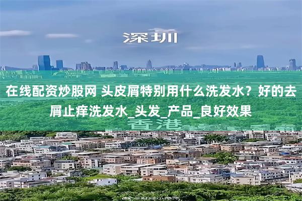 在线配资炒股网 头皮屑特别用什么洗发水？好的去屑止痒洗发水_头发_产品_良好效果