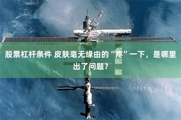 股票杠杆条件 皮肤毫无缘由的“疼”一下,是哪里出了问题?